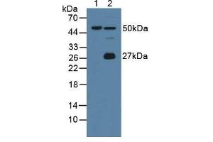 Figure. (Intrinsic Factor anticorps  (AA 31-288))