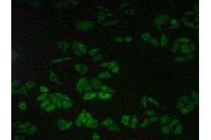 Detection of CAPN2 in Human Hela Cells using Polyclonal Antibody to Calpain 2 (CAPN2) (Calpain 2 anticorps  (AA 45-514))