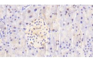 Detection of NUP88 in Mouse Pancreas Tissue using Polyclonal Antibody to Nucleoporin 88 (NUP88) (NUP88 anticorps  (AA 57-296))