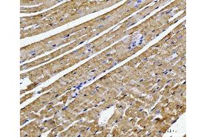 IHC analysis of ATP5F1B using anti-ATP5F1B antibody (ABIN7599866). (Atp5f1b (AA 123-529) anticorps)