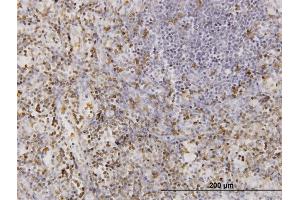 Immunoperoxidase of monoclonal antibody to CD177 on formalin-fixed paraffin-embedded human lymph node.