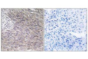 Immunohistochemistry (IHC) image for anti-Chondroitin Polymerizing Factor (CHPF) (C-Term) antibody (ABIN1851108) (CHPF anticorps  (C-Term))