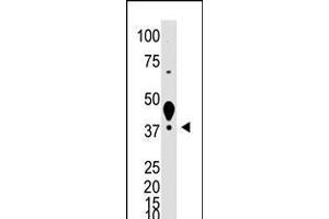 Antibody is used in Western blot to detect XLKD1 in mouse liver tissue lysate. (LYVE1 anticorps  (N-Term))
