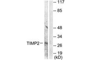 Western blot analysis of extracts from A549 cells, using TIMP2 Antibody. (TIMP2 anticorps  (AA 21-70))