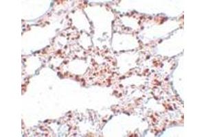 Immunohistochemistry (IHC) image for anti-Zinc Finger and SCAN Domain Containing 4 (ZSCAN4) (C-Term) antibody (ABIN1030831) (ZSCAN4 anticorps  (C-Term))