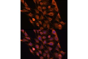 Immunofluorescence analysis of C6 cells using RNH1 Rabbit pAb (ABIN1682553, ABIN3018507, ABIN3018508 and ABIN6220489) at dilution of 100 (40x lens). (RNH1 anticorps  (AA 202-461))