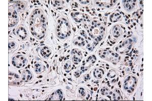 Immunohistochemical staining of paraffin-embedded breast tissue using anti-MAPK12 mouse monoclonal antibody. (MAPK12 anticorps)