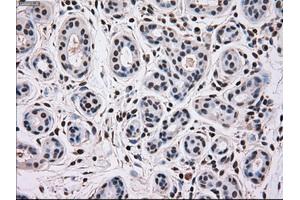 Immunohistochemical staining of paraffin-embedded breast tissue using anti-MAPK12 mouse monoclonal antibody.