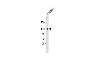 Anti-CACNA2D2 Antibody (Center) at 1:2000 dilution + mouse kidney lysate Lysates/proteins at 20 μg per lane. (CACNA2D2 anticorps  (AA 643-671))