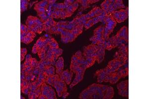 anti-Claudin 3 (CLDN3) (AA 101-220) antibody