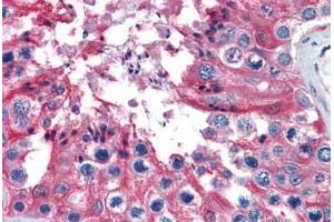 Human Testis: Formalin-Fixed, Paraffin-Embedded (FFPE)