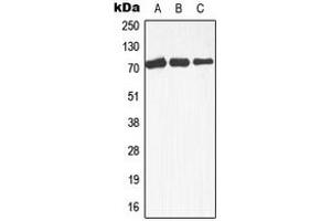 Western blot analysis of MEKK3 expression in Raji (A), A431 (B), HepG2 (C) whole cell lysates. (MAP3K3 anticorps  (Center))
