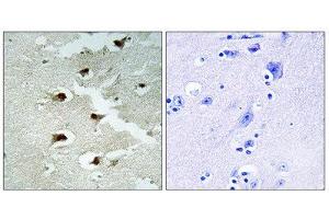 Immunohistochemistry (IHC) image for anti-Cell Division Cycle Associated 4 (CDCA4) (Internal Region) antibody (ABIN1850258) (CDCA4 anticorps  (Internal Region))