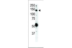 Western blot analysis of anti-Ret Pab (ABIN392038 and ABIN2841806) in SKBR3 cell lysate. (Ret Proto-Oncogene anticorps  (N-Term))