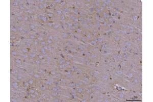 IHC analysis of ADAM22 using anti-ADAM22 antibody (ABIN7600714). (ADAM22 anticorps  (AA 223-829))