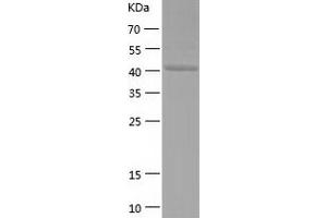 Western Blotting (WB) image for Synaptotagmin IV (SYT4) (AA 38-425) protein (His-IF2DI Tag) (ABIN7125275)