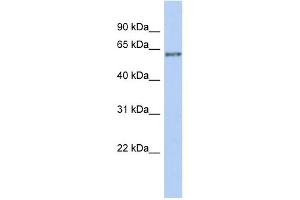 WB Suggested Anti-PCCB Antibody Titration: 0. (PCCB anticorps  (Middle Region))
