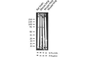 Western blot analysis of Phospho-p70 S6 Kinase (Thr229) expression in various lysates