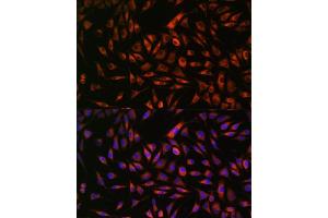 Immunofluorescence analysis of L929 cells using EML4 antibody (ABIN7266891) at dilution of 1:100.