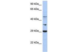 Image no. 1 for anti-Pyruvate Dehydrogenase Kinase, Isozyme 3 (PDK3) (C-Term) antibody (ABIN6743407) (PDK3 anticorps  (C-Term))