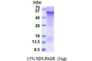 Sprouty-Related, EVH1 Domain Containing 1 (SPRED1) (AA 1-444) protein (His tag)