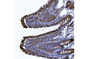 IHC analysis of CD103/Itgae using anti-CD103/Itgae antibody (ABIN7600516).