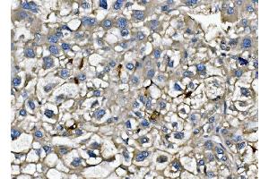 IHC analysis of CXCL12 using anti-CXCL12 antibody (ABIN6719467).