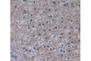 IHC-P analysis of liver tissue, with DAB staining. (MARS anticorps  (AA 74-198))