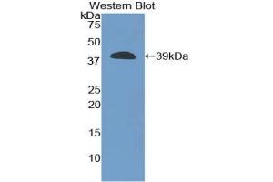Detection of Recombinant CPB1, Human using Polyclonal Antibody to Carboxypeptidase B1, Tissue (CPB1) (CPB1 anticorps  (AA 109-415))