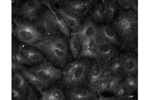 Immunofluorescent staining of A549 (ATCC CCL-185) cells.