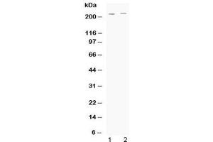 Western blot testing of human 1) HeLa and 2) A549 cell lysate with ABCC1 antibody at 0. (ABCC1 anticorps  (AA 1493-1528))