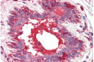 Human Breast (formalin-fixed, paraffin-embedded) stained with HGF antibody ABIN461958 at 10 ug/ml followed by biotinylated anti-mouse IgG secondary antibody ABIN481714, alkaline phosphatase-streptavidin and chromogen. (HGF anticorps)