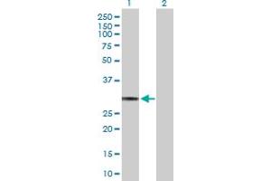 Western Blot analysis of HLA-DQA1 expression in transfected 293T cell line by HLA-DQA1 MaxPab polyclonal antibody. (HLA-DQA1 anticorps  (AA 1-255))