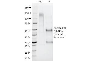 SDS-PAGE Analysis Purified AMACR / p504S Rabbit Polyclonal Antibody.