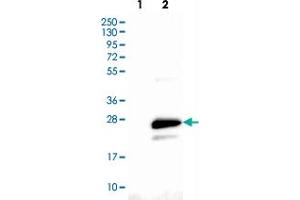 Western blot analysis of Lane 1: Negative control (vector only transfected HEK293T lysate), Lane 2: Over-expression Lysate (Co-expressed with a C-terminal myc-DDK tag (~3. (CMTM6 anticorps)