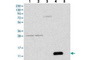 Western blot analysis of Lane 1: RT-4, Lane 2: U-251 MG, Lane 3: Human Plasma, Lane 4: Liver, Lane 5: Tonsil with FCER1G polyclonal antibody .