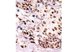 Image no. 2 for anti-Met Proto-Oncogene (MET) (pTyr1349) antibody (ABIN358164) (c-MET anticorps  (pTyr1349))