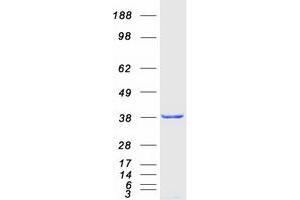 Validation with Western Blot