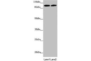 Western blot All lanes: PDE6A antibody at 3. (PDE6A anticorps  (AA 656-860))