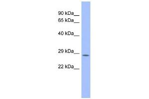 WB Suggested Anti-PSMB10 Antibody Titration: 0. (PSMB10 anticorps  (Middle Region))