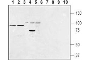 Western blot analysis of rat fat (lanes 1 and 6), mouse fat (lanes 2 and 7), human Burkitt's lymphoma (Raji) (lanes 3 and 8), rat basophilic leukemia (RBL) (lanes 4 and 9) and human promyelocytic leukemia (HL-60) (lanes 5 and 10) lysates: - 1-5. (F4/80 anticorps  (Extracellular, N-Term))