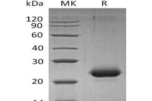 Western Blotting (WB) image for CD40 (CD40) (Active) protein (His tag) (ABIN7320760) (CD40 Protein (CD40) (His tag))