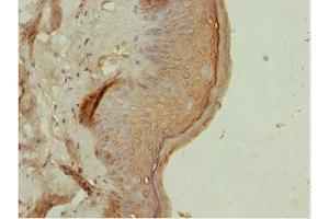 Immunohistochemistry of paraffin-embedded human skin tissue using ABIN7144821 at dilution of 1:100