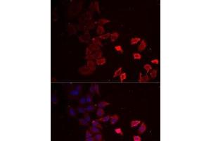 Immunofluorescence analysis of MCF7 cells using P2RX4 Polyclonal Antibody (P2RX4 anticorps)