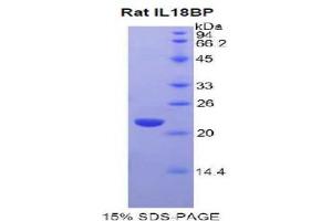 SDS-PAGE analysis of Rat IL18BP Protein. (IL18BP Protéine)