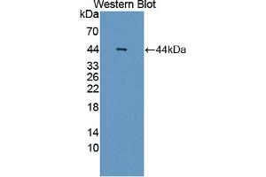 Detection of Recombinant AIM2, Human using Polyclonal Antibody to Absent In Melanoma 2 (AIM2) (AIM2 anticorps  (AA 1-343))