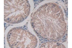 Used in DAB staining on fromalin fixed paraffin- embedded stomach tissue (GAS6 anticorps  (AA 100-312))