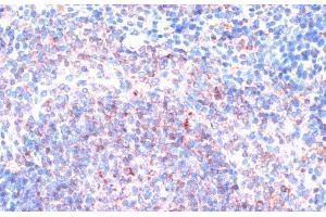 Immunohistochemistry of paraffin-embedded Mouse spleen using P90RSK Polyclonal Antibody at dilution of 1:100 (40x lens). (RPS6KA3 anticorps)