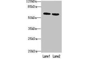 Western blot All lanes: BTN2A2 antibody at 10 μg/mL Lane 1: MCF-7 whole cell lysate Lane 2: NIH/3T3 whole cell lysate Secondary Goat polyclonal to rabbit IgG at 1/10000 dilution Predicted band size: 60, 38, 29, 46, 36 kDa Observed band size: 60 kDa
