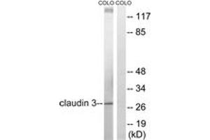 Western blot analysis of extracts from COLO205 cells, treated with EGF 200ng/ml 30', using Claudin 3 (Ab-219) Antibody. (Claudin 3 anticorps  (AA 171-220))